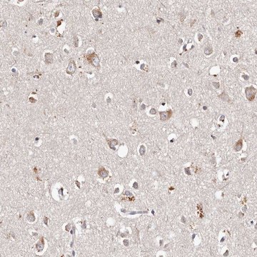 Anti-TSC2 antibody produced in rabbit Prestige Antibodies&#174; Powered by Atlas Antibodies, affinity isolated antibody, buffered aqueous glycerol solution