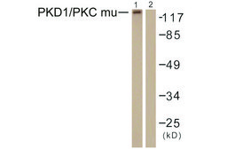 Anti-PKD1 antibody produced in rabbit affinity isolated antibody