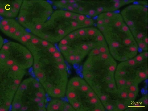 抗 HNF1B 兔抗 Prestige Antibodies&#174; Powered by Atlas Antibodies, affinity isolated antibody, buffered aqueous glycerol solution