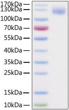 Recombinant 2019-nCoV Spike S1 Protein with His and Avi tag