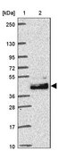 Anti-LRTM2 antibody produced in rabbit Prestige Antibodies® Powered by Atlas Antibodies, affinity isolated antibody, buffered aqueous glycerol solution