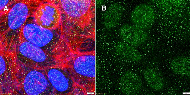 Anti-CDX2 Antibody, clone 1N7 ZooMAb&#174; Rabbit Monoclonal recombinant, expressed in HEK 293 cells