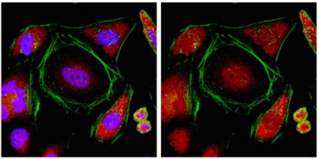 Anti-TNRC6B Antibody from rabbit, purified by affinity chromatography