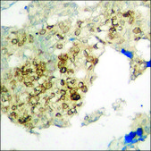Anti-phospho-CaMK1-α (pThr177) antibody produced in rabbit affinity isolated antibody