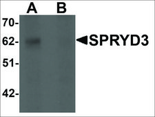 Anti-SPRYD3 antibody produced in rabbit affinity isolated antibody