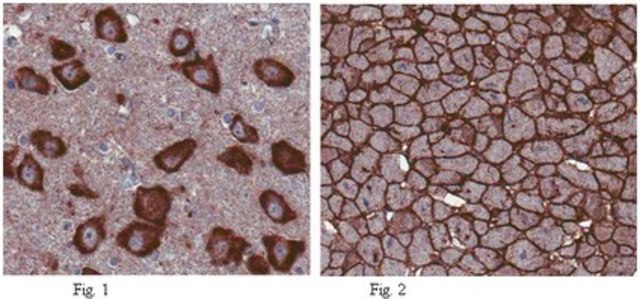 Anti-T-cadherin (CDH13) Antibody from rabbit, purified by affinity chromatography