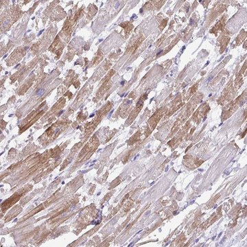 Anti-ST8SIA2 antibody produced in rabbit Prestige Antibodies&#174; Powered by Atlas Antibodies, affinity isolated antibody, buffered aqueous glycerol solution