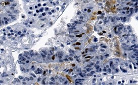 Anti-phospho-Chk2-Thr68 Antibody, clone 1B17 ZooMAb® Rabbit Monoclonal recombinant, expressed in HEK 293 cells