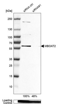 Anti-MBOAT2 antibody produced in rabbit Prestige Antibodies&#174; Powered by Atlas Antibodies, affinity isolated antibody, buffered aqueous glycerol solution