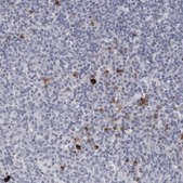 Anti-GZMH antibody produced in rabbit Prestige Antibodies® Powered by Atlas Antibodies, affinity isolated antibody, buffered aqueous glycerol solution