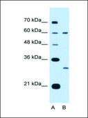 Anti-TSPAN32 (AB2) antibody produced in rabbit IgG fraction of antiserum