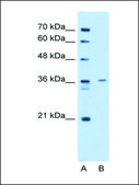 Anti-TPM2 antibody produced in rabbit IgG fraction of antiserum