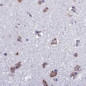Anti-RPS15 antibody produced in rabbit Prestige Antibodies® Powered by Atlas Antibodies, affinity isolated antibody, buffered aqueous glycerol solution