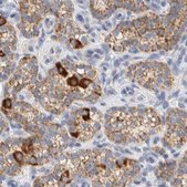 Anti-HDHD3 antibody produced in rabbit Prestige Antibodies® Powered by Atlas Antibodies, affinity isolated antibody, buffered aqueous glycerol solution, Ab2