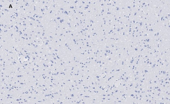 Anti-VGluT1 Antibody, clone 4O15, ZooMAb&#174; Rabbit Monoclonal recombinant, expressed in HEK 293 cells