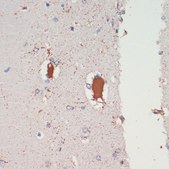 Anti-LRRK2 antibody produced in rabbit