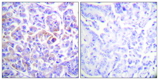 Anti-C-RAF antibody produced in rabbit affinity isolated antibody