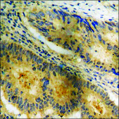 Anti-phospho-c-Jun (pSer73) antibody produced in rabbit affinity isolated antibody