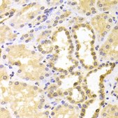 Anti-S100A11 antibody produced in rabbit