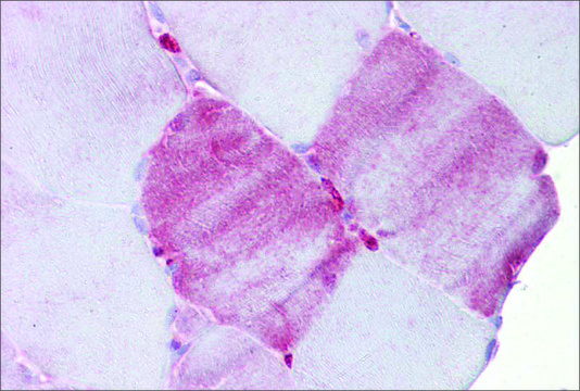 Anti-FABP3 antibody produced in rabbit affinity isolated antibody