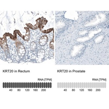 Monoclonal Anti-KRT20 antibody produced in mouse Prestige Antibodies® Powered by Atlas Antibodies, clone CL9390, purified immunoglobulin, buffered aqueous glycerol solution