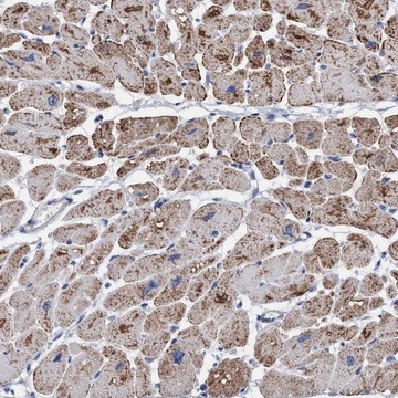 Anti-RSAD1 antibody produced in rabbit Prestige Antibodies&#174; Powered by Atlas Antibodies, affinity isolated antibody, buffered aqueous glycerol solution, Ab1