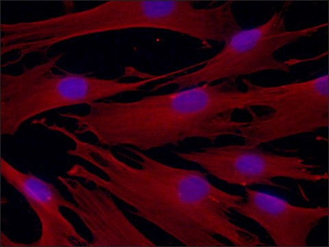 Anti-&#946;-Tubulin IV antibody, Mouse monoclonal clone ONS.1A6, purified from hybridoma cell culture