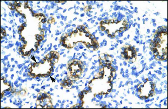 Anti-RFP2 (AB1) antibody produced in rabbit affinity isolated antibody