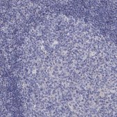 Anti-EPDR1 antibody produced in rabbit Prestige Antibodies® Powered by Atlas Antibodies, affinity isolated antibody, buffered aqueous glycerol solution
