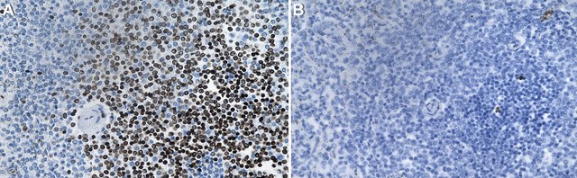 Anti-FAN1 Antibody, clone 2B15 ZooMAb&#174; Rabbit Monoclonal recombinant, expressed in HEK 293 cells