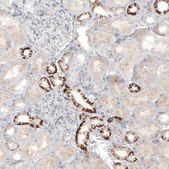 Anti-L1CAM antibody produced in rabbit Prestige Antibodies® Powered by Atlas Antibodies, affinity isolated antibody, buffered aqueous glycerol solution