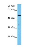 Anti-HS6ST3 antibody produced in rabbit affinity isolated antibody