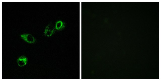 Anti-CCRL1 antibody produced in rabbit affinity isolated antibody