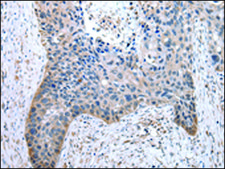 Anti-TOR1A affinity isolated antibody