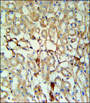 ANTI-KCNV1 (N-TERM) antibody produced in rabbit IgG fraction of antiserum, buffered aqueous solution