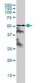 ANTI-RARA antibody produced in mouse clone 1C10, purified immunoglobulin, buffered aqueous solution