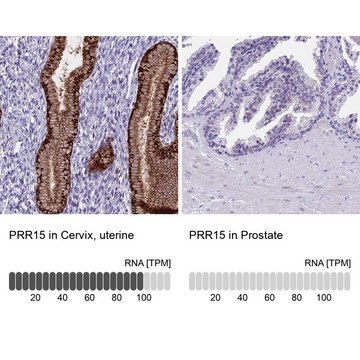 Anti-PRR15 antibody produced in rabbit Prestige Antibodies&#174; Powered by Atlas Antibodies, affinity isolated antibody, buffered aqueous glycerol solution