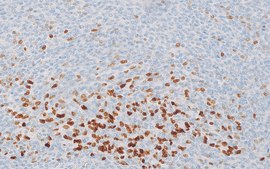 PAX-7 (MRQ-69) Mouse Monoclonal Antibody
