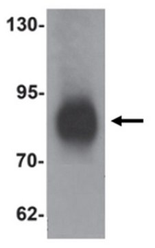 Anti-LRRFIP1 Antibody from rabbit, purified by affinity chromatography