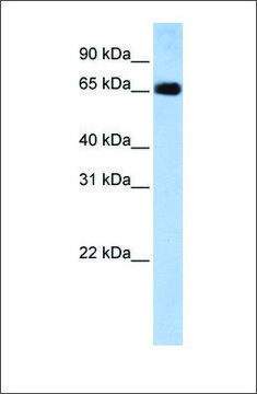 Anti-SLC22A13 antibody produced in rabbit affinity isolated antibody