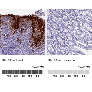 Anti-KRT6A antibody produced in rabbit Prestige Antibodies&#174; Powered by Atlas Antibodies, affinity isolated antibody, buffered aqueous glycerol solution