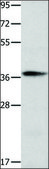 Anti-CTSV antibody produced in rabbit affinity isolated antibody