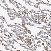 Anti-SLC43A3 antibody produced in rabbit Prestige Antibodies® Powered by Atlas Antibodies, affinity isolated antibody, buffered aqueous glycerol solution