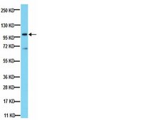 Anti-Phospholipase A2 Antibody, clone CH-7 clone CH-7, from mouse