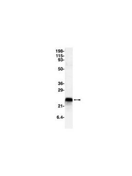 Anti-CPI-17 Antibody Upstate&#174;, from rabbit