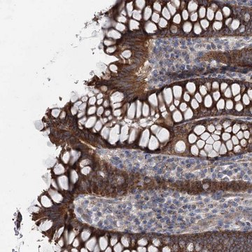 抗-MARK2 兔抗 Prestige Antibodies&#174; Powered by Atlas Antibodies, affinity isolated antibody, buffered aqueous glycerol solution