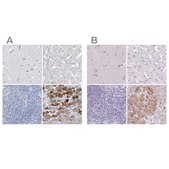 Anti-CTRL antibody produced in rabbit Prestige Antibodies® Powered by Atlas Antibodies, affinity isolated antibody, buffered aqueous glycerol solution