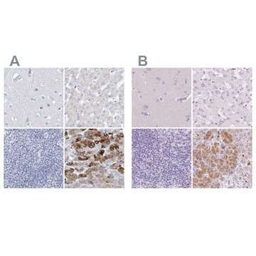 Anti-CTRL antibody produced in rabbit Prestige Antibodies&#174; Powered by Atlas Antibodies, affinity isolated antibody, buffered aqueous glycerol solution