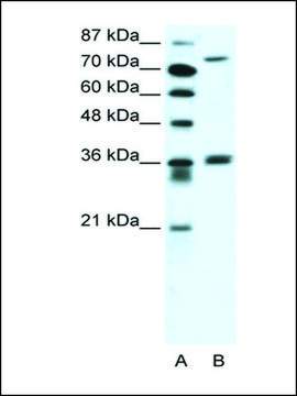 Anti-MID1 antibody produced in rabbit IgG fraction of antiserum