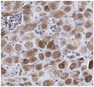 Anti-KLF6 Antibody, clone 12A8.3 clone 12A8.3, from mouse